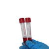 virus transport media